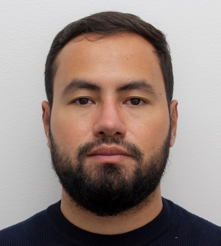 Otoplastia Facial Dr Ruber